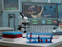 Važnost laboratorijskih testova u ranoj dijagnostici bolesti